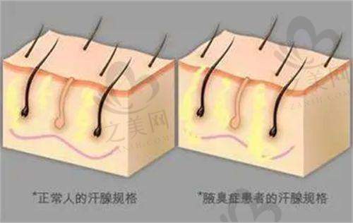 翡立思与伯思立的关系