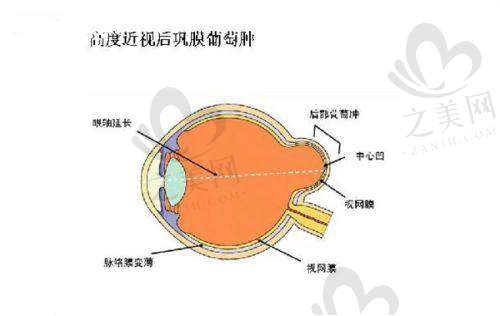 医院排名依据分析