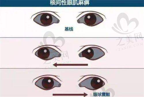 郑州新视界眼科医院:性价比黑马