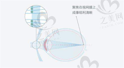 预约挂号及流程