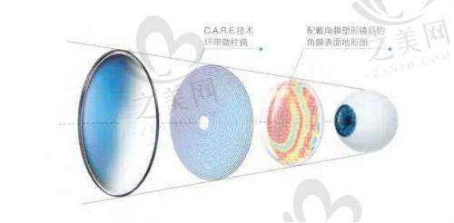 内蒙古医学院第一附属医院眼科亮点