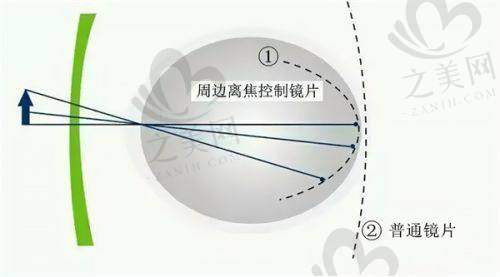 成都青羊萌鹰眼科的收费标准