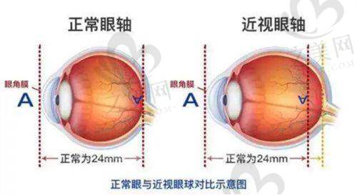 苏州昆山爱尔眼科特色