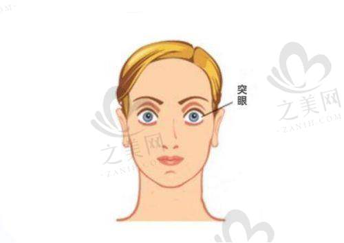 成都睛彩眼科医院特色