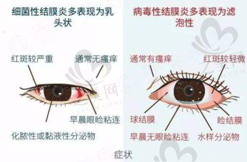 呼和浩特光正眼科医院优势