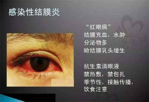 郑州博爱眼科医院:ICL晶体植入特色医院