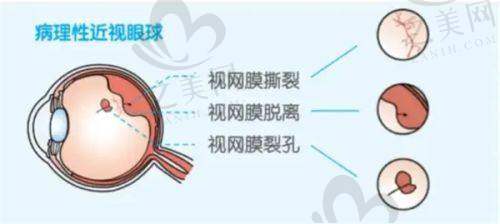 部分医院优势介绍——青岛鹿晰眼科医院