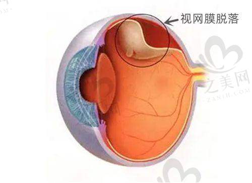长沙博视眼科医院价格与地址