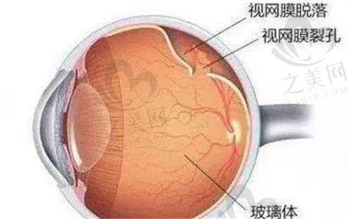 天津首爱眼科医院患者口碑与价格透明度
