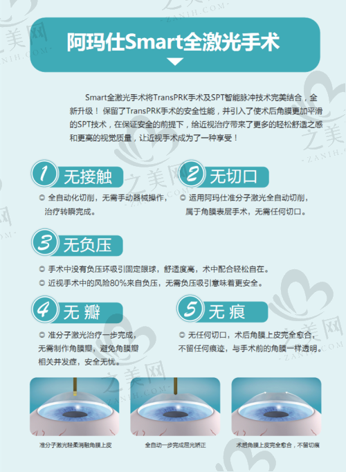 徐州全飞秒激光手术医院排名及优势
