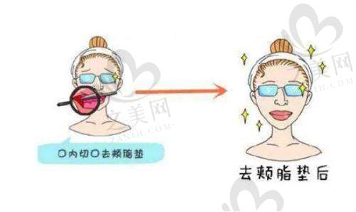 总结
