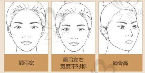 四、伊莱美医疗美容医院