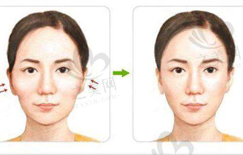 康美整形医院正规口碑好,南京/苏州/南通康美整形皮肤护理低至199元起,附地址及咨询电话