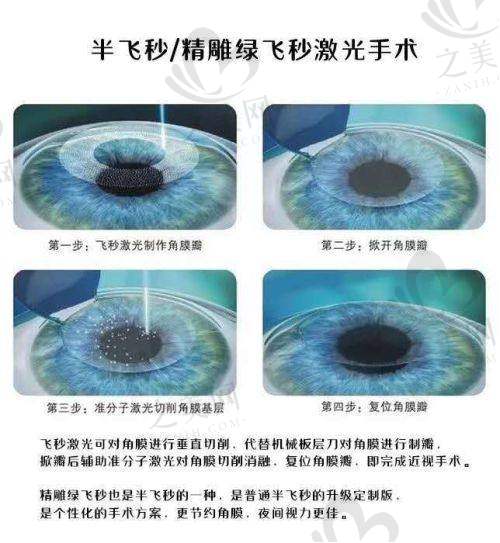 保定部分眼科医院收费情况