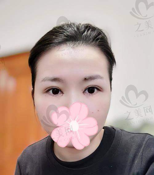 四、选择医院时需要注意的事项