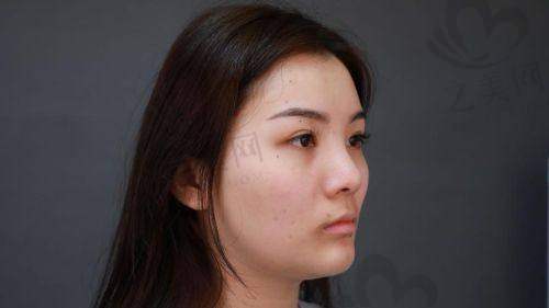 其他东莞鼻修复医院价格与医生情况