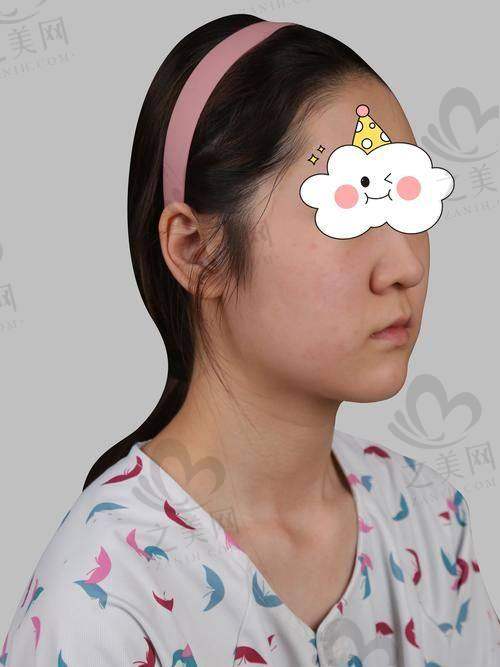 上海黄浦区埋线隆鼻医院推荐与排名,全面解析2025正规收费标准与价格一览表