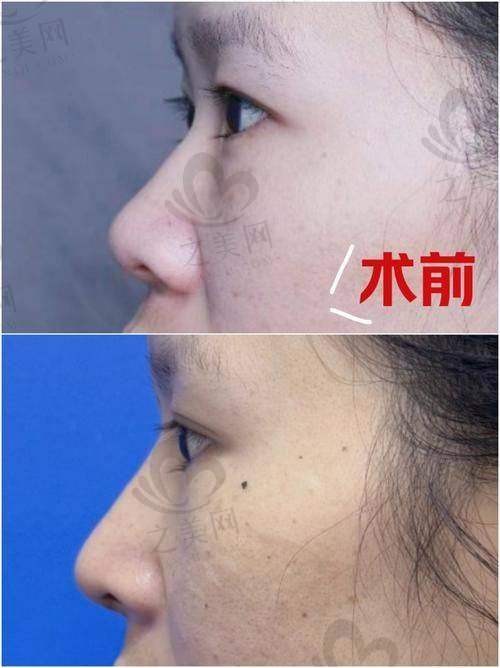 广州华美医疗美容医院口碑良好
