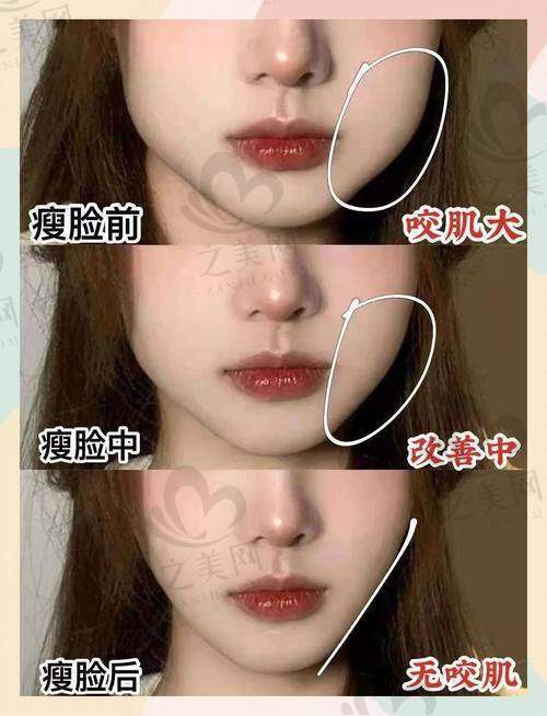 昆明不同修复方式的价格范围