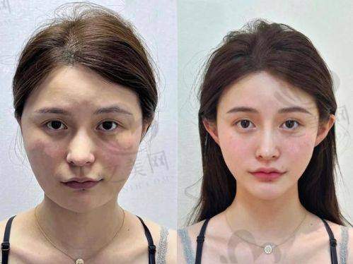 推荐医生刘艳的技术特点
