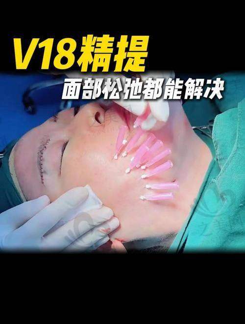 2025成都面部提升医生排名前十有谁?成都素美李建钢常年霸榜,成都八大处侯典举医生面颈部年轻化手术超赞