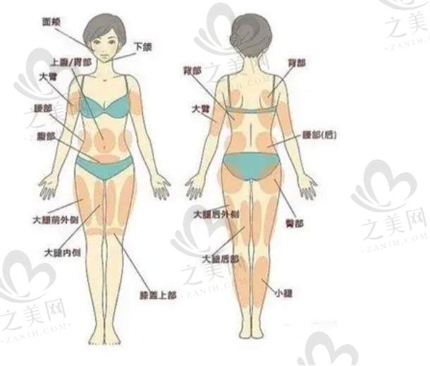 北京艺星整形医院正规靠谱,腿部吸脂实例评价好,价格透明 8800元起