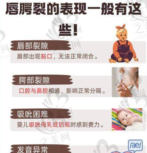 郑州大学第二附属医院正美医疗美容唇裂修复效果好,李钢医生经验足,3000元起
