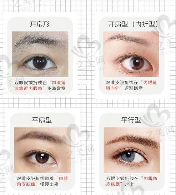 眼部整形修复不用愁!北京客莱美舍张冰洁院长,双眼皮修复36000起助你重焕睛彩