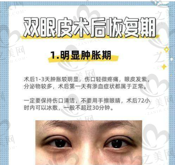 想做眼部和面部修复不用愁!韩国院长韩万旭,眼部修复29800元起,mini小切口提拉69800元起