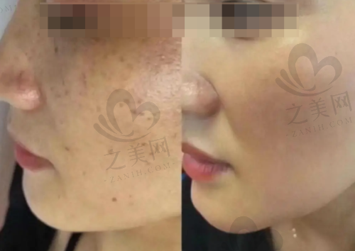 医院选择的关键因素