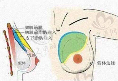 天津激光祛斑哪个医院好