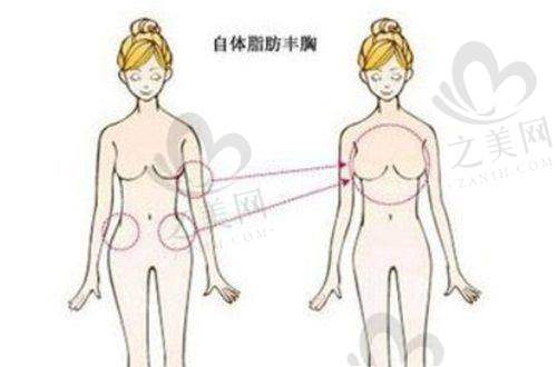戴传昌医生的擅长领域