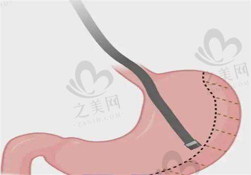 哈尔滨医 大四院美容科激光祛斑价格参考