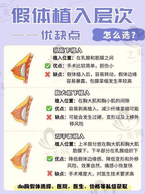 成都高新米兰柏羽机构优势
