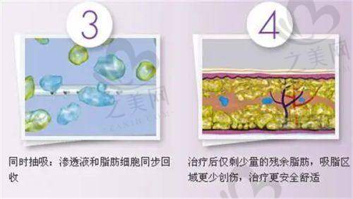 如何选择合适的医生