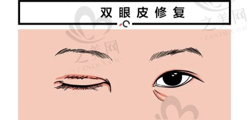 长春激光祛斑价格及正规医院情况,中妍美容医院价格表曝光,雀斑1200-2800元不等