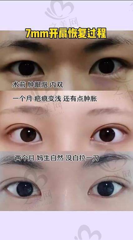 主推项目介绍