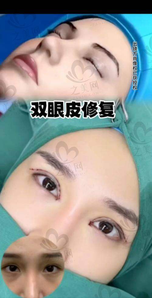 张冰洁院长：眼部整形修复界的明星