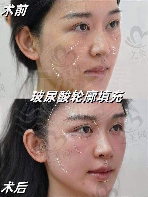 如何获取南京韩辰美容医院更多信息