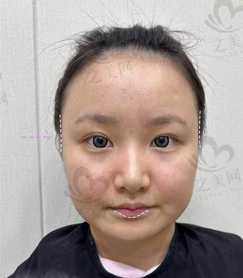 广州高尚整形美容医院：专精可靠之选