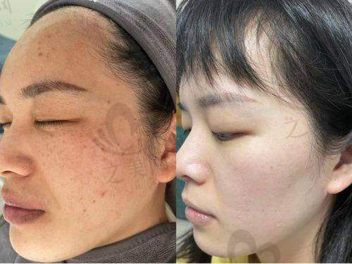 长沙晶肤医疗美容项目特色
