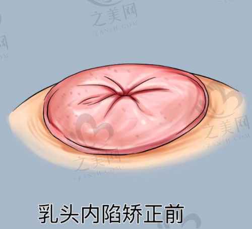 医美项目丰富度