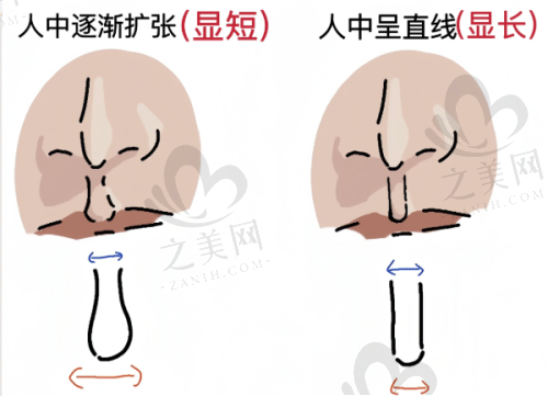 熱門(mén)項(xiàng)目介紹