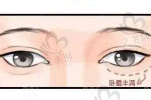 隆鼻与开眼角项目分析