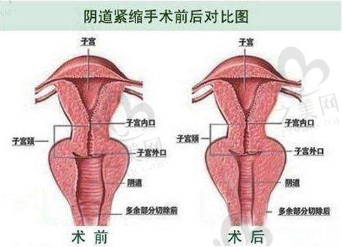 适合项目分析