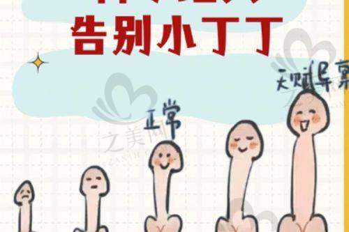 植发情况