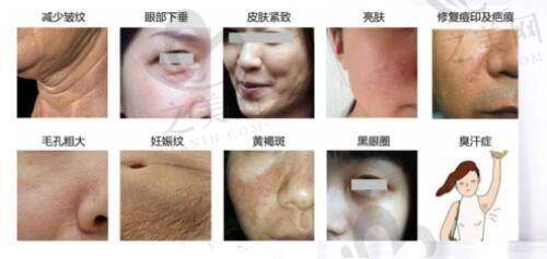 口碑与顾客反馈