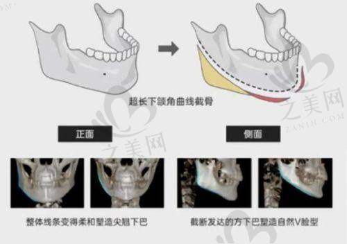 实用指南与避坑小贴士