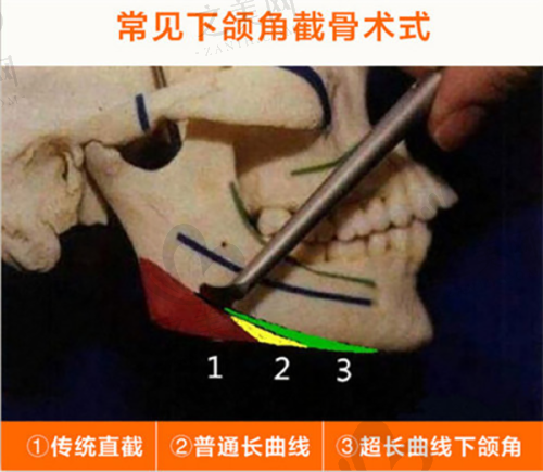 深圳大学总医院整形美容科怎么样,在几楼?专业团队、先进设备、丰富项目,口碑排名双优!