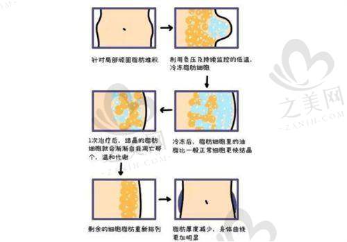 主推项目介绍